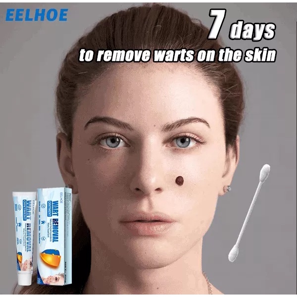 Serum gel tẩy nốt ruồi xóa mụn ruồi trên mặt, tàn nhang, mụn cóc, mụn thịt , mụn cơm, mắt cá tại nhà an toàn và gel mờ s