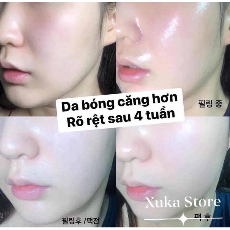 [ĐỦ BILL] SET TẨY DA CHẾT HOÁ HỌC DẠNG SỮA CNP MILK TONING PEEL PROGRAM