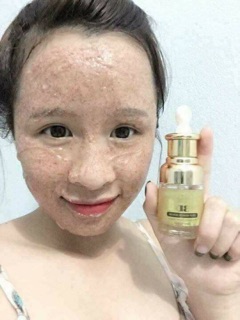 SERUM TÁI TẠO DA 3D