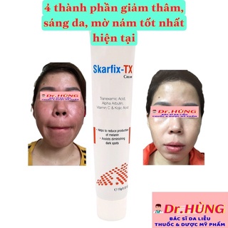 Skarfix-TX Cream Kem Dưỡng Da Mờ Thâm, Tàn Nhang Fixderma 15gr