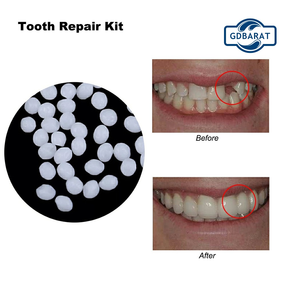 Bộ Dụng Cụ Chăm Sóc Răng Miệng Chuyên Dụng