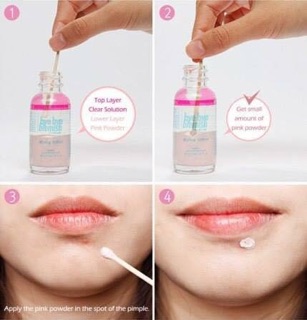 Chăm sóc da mụn Bye Bye Blemish