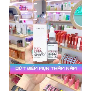 Serum Tái Tạo Da Red Peel Tingle