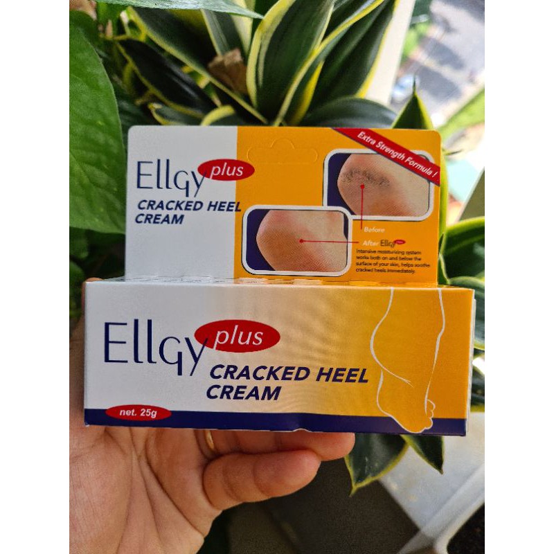 Kem Trị Nứt Gót Chân Ellgy Plus 25g