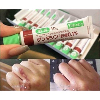 Kem trị sẹo Gentacin Nhật Bản