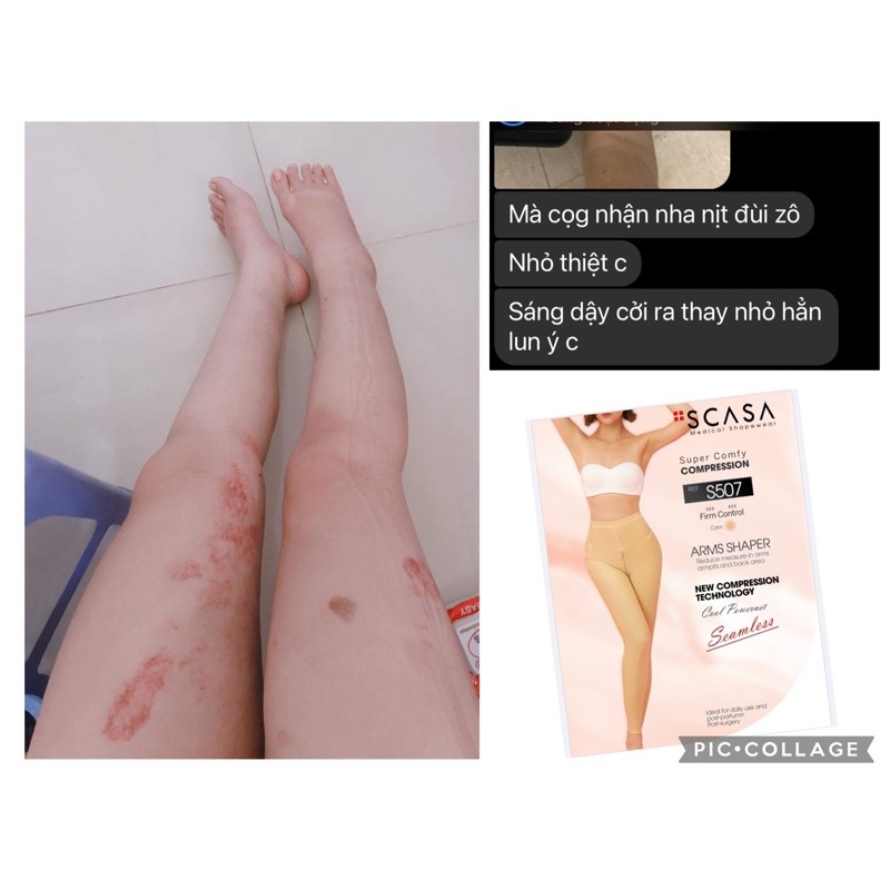 [Chính hãng] Quần gen đùi sau hút mỡ Scasa S507 | BigBuy360 - bigbuy360.vn