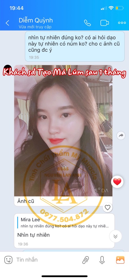 Tinh Chất Tạo Má Núm Đồng Tiền Miracle