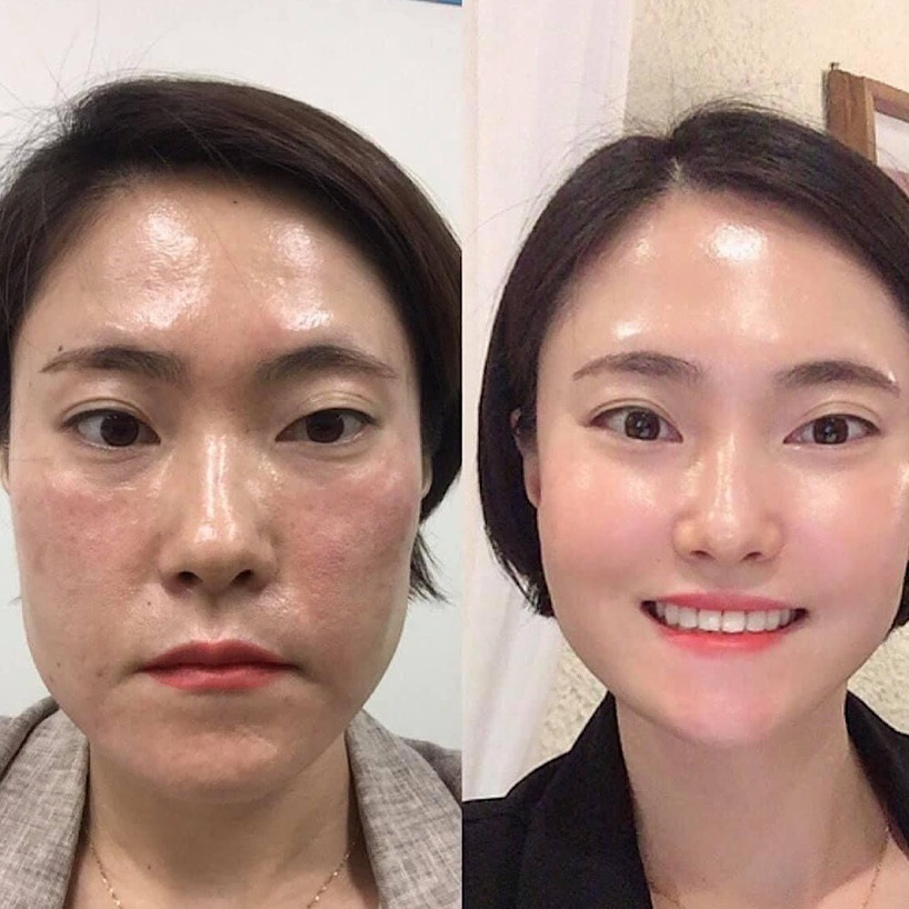 1 ống Sample Peel tái tạo da chuyên sâu CNP Rx Skin Rejuvenating Intensive Peel