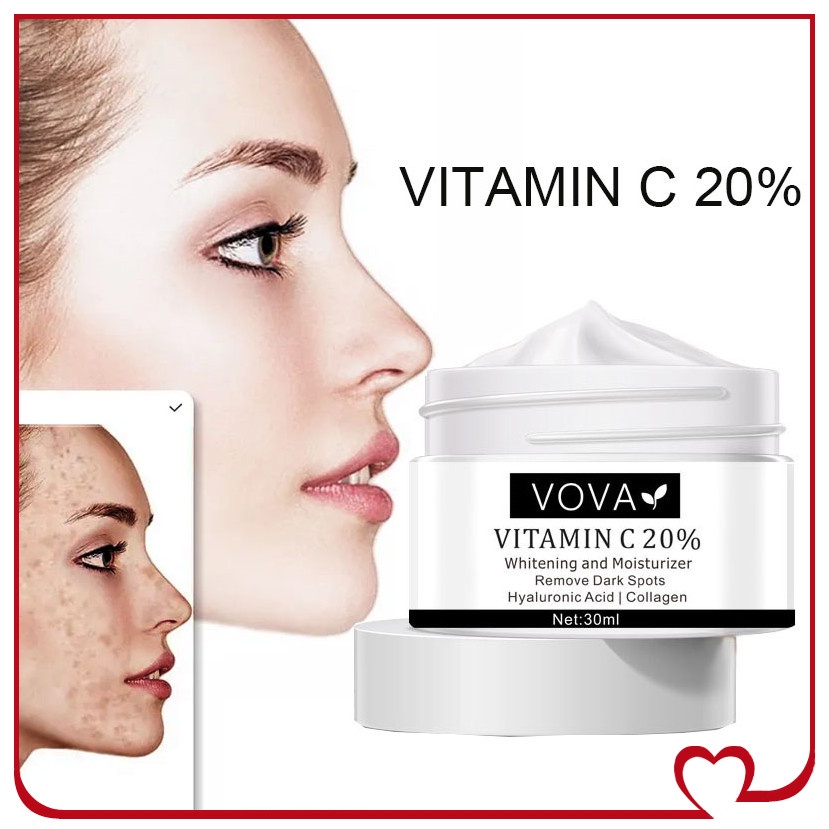Vova 30Ml Vitamin C Tàn Nhang Kem Loại Bỏ Hắc Sắc Tố Màu Dán Cường Lực Mảng Bám Điểm Loại Bỏ Làm Sáng Sắc Tố Dưỡng Ẩm Làm Trắng Da