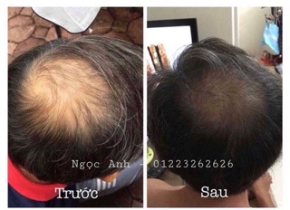 Combo Thảo Dược Gội Đầu và Xả Mộc