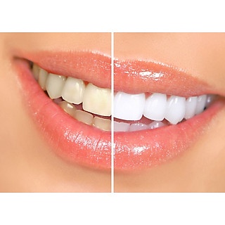 Bột Tẩy Trắng Răng Artcolor Nga 75g