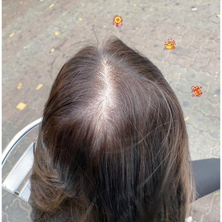 [Chính hãng] Tinh Dầu KÍCH MỌC - TRỊ HÓI Premium Total Hair Tonic | BigBuy360 - bigbuy360.vn