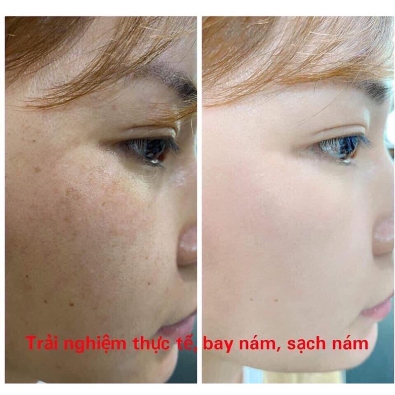 Kem Nám Trắng Da FIERA Chính Hãng