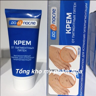 Kem trị đồi mồi nga