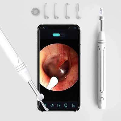 Camera Nội Soi Không Dây, Que Lấy Ráy Tai Siêu Nét Tại Nhà - Wifi- Chống nước- Dễ Sử Dụng