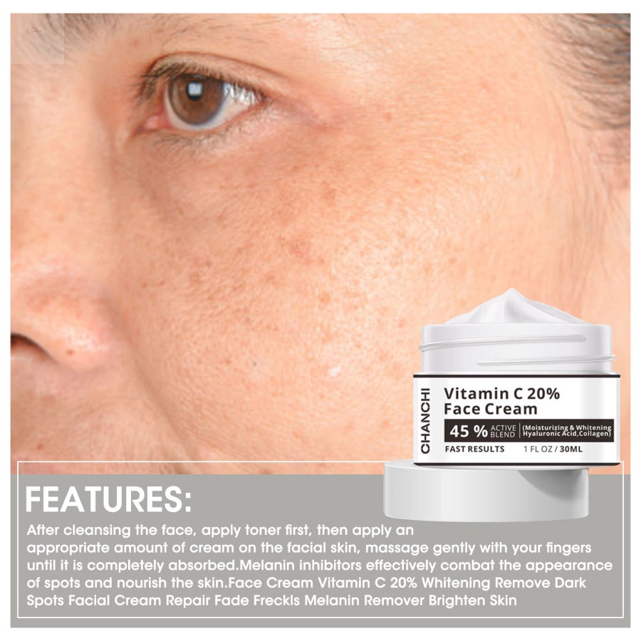 Kem Vitamin C 20% Làm Trắng Xóa Đốm Đen Trên Da Mặt Hiệu GLAMN