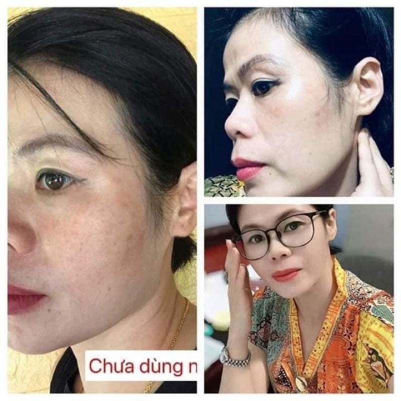 [CAM KẾT CHÍNH HÃNG] Kem Nám Huyền Phi 30g
