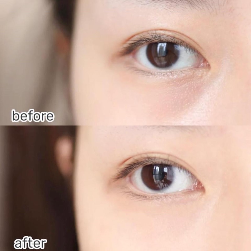 SERUM DƯỠNG MẰT VICHY 89 YEUX