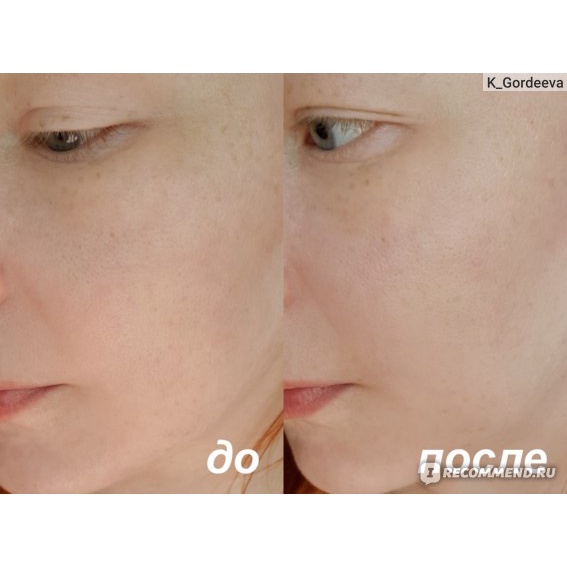 Toner Eveline 5% Glycolic acid (vàng) sáng da, se khít chân lông, giảm nhăn