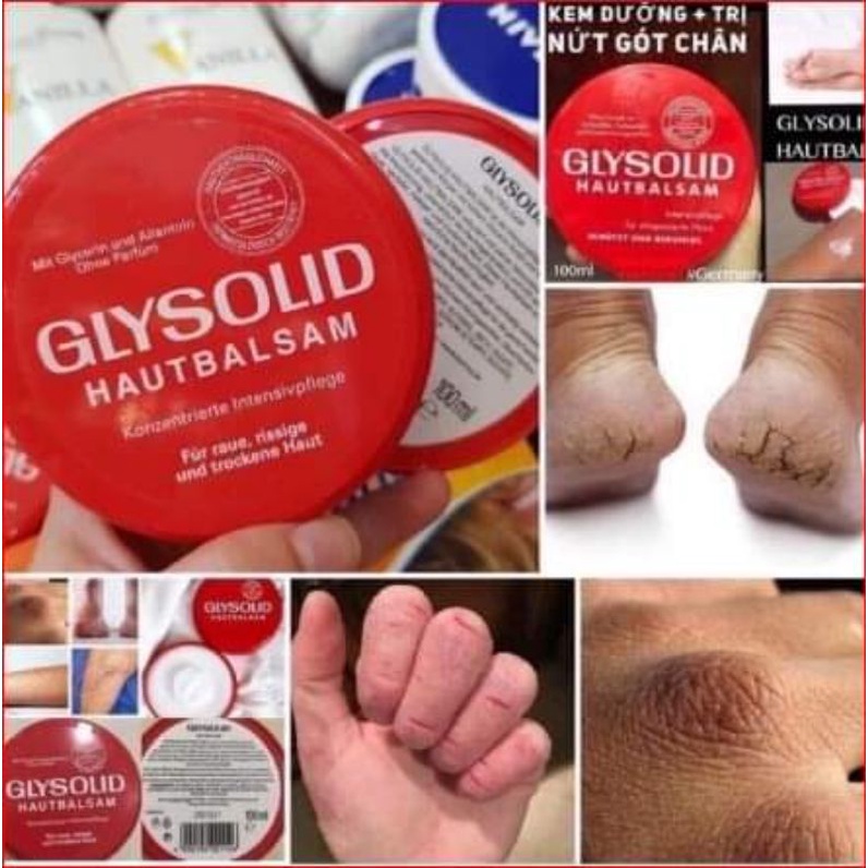 Kem Làm Mềm Da Chân