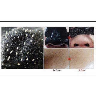 Mặt nạ lột mụn NASNON Charcoal Pore Clear pack