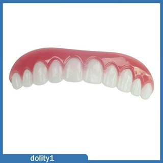 [Dolity1] Veneers trên dưới giả sáng