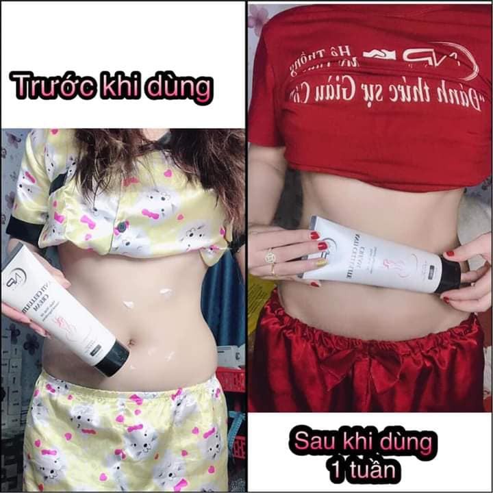 [THANH LÝ] KEM TAN MỠ NELLY.P