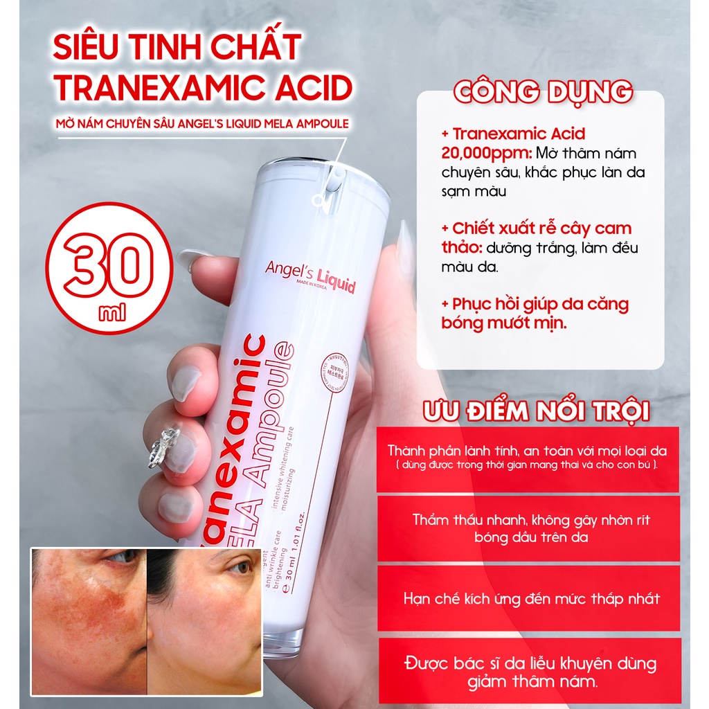 Siêu Tinh Chất Xoá Thâm Đỏ Mờ Sạm Nám Angel's Liquid Tranexamic Mela Ampoule 30ml