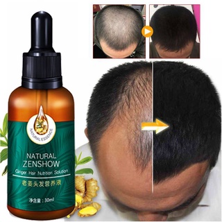Thuốc mọc tóc Tinh dầu mọc tóc 30ml Xịt kích mọc tóc Chăm sóc tóc chống rụng tóc Kích thích tóc mọc dà