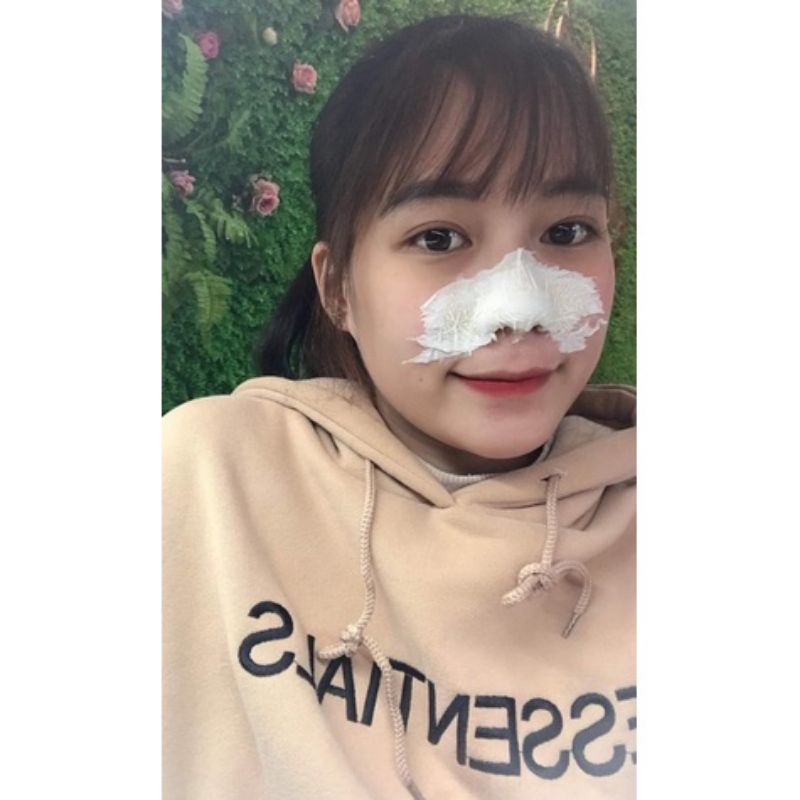 Keo lột mụn handmade