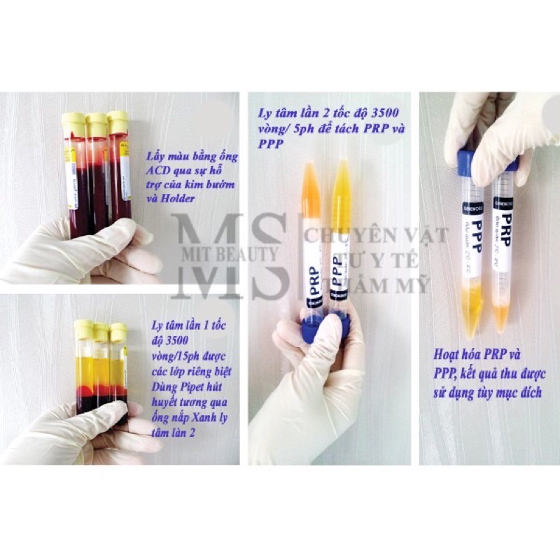 Bộ KIT PRP ACD Mỹ HÀNG CÔNG TY 12 món