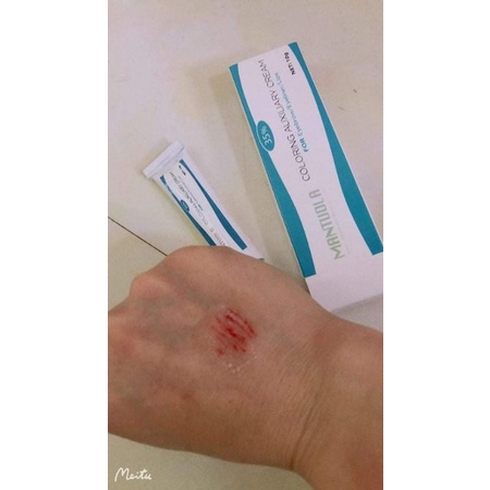 Tê ý phun xăm thẩm mỹ