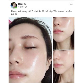 Serum HA+ dưỡng da