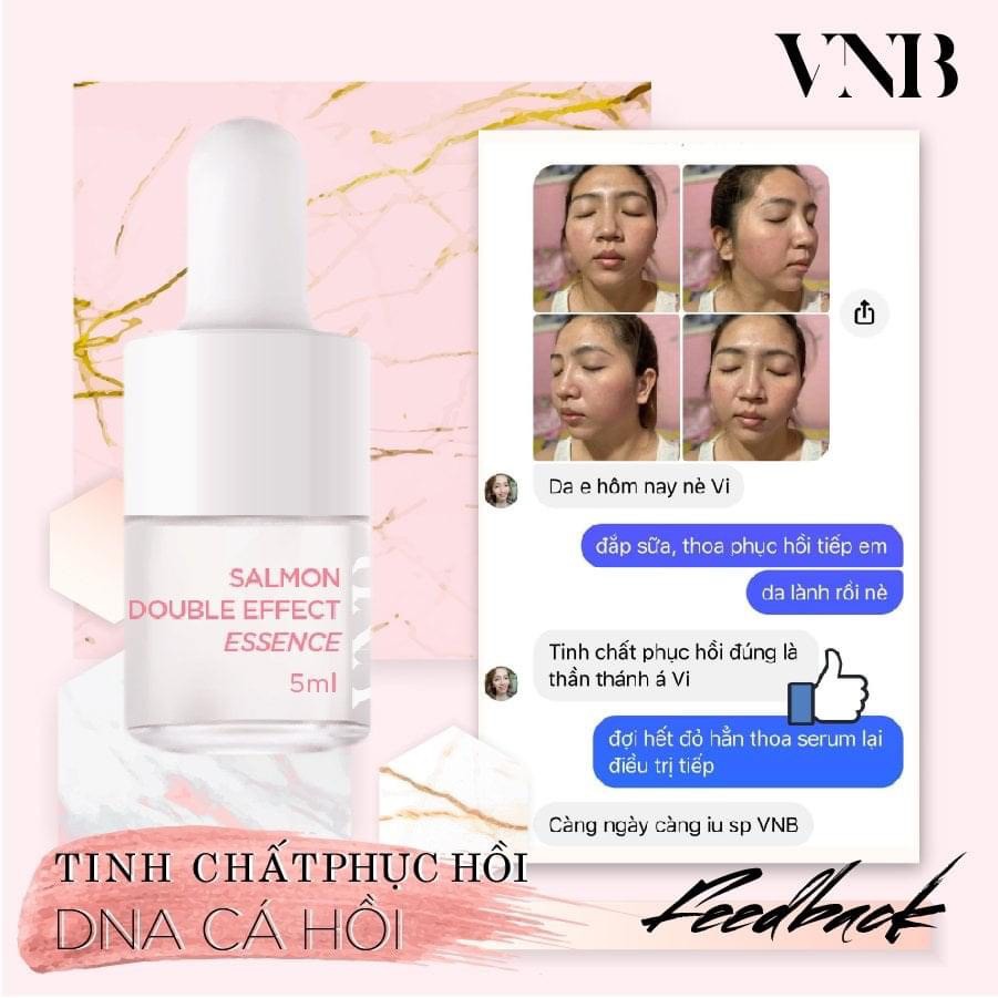 [chính hãng] SERUM CẤP ẨM GIÚP PHỤC HỒI DA 𝐒𝐀𝐋𝐌𝐎𝐍 𝐃𝐎𝐔𝐁𝐋𝐄 𝐄𝐅𝐅𝐄𝐂𝐓 𝐄𝐒𝐒𝐄𝐍𝐂𝐄 VNB