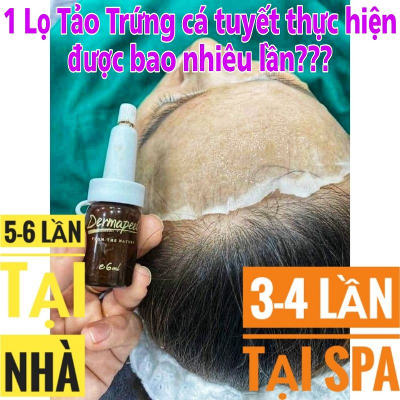 Tảo trứng cá tuyết Dermapeel+ KHÔNG BONG DA - Vì Làn Da Hoàn Hảo - SẠCH MỤN - MỜ THÂM NÁM - TÁI TẠO MÔ DA