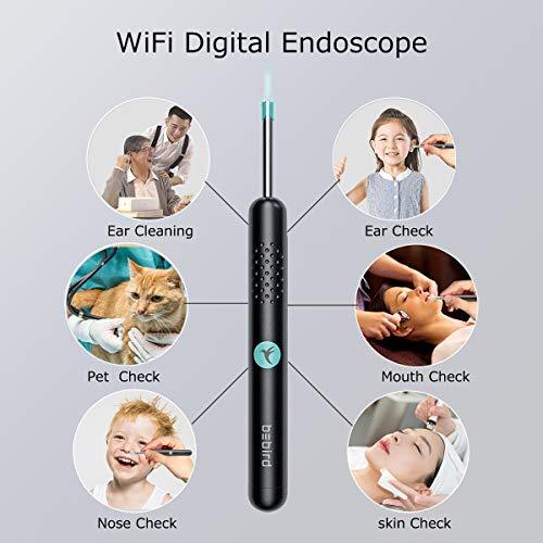 Dụng cụ lấy ráy tai nội soi Bebird R1 - máy lấy ráy tai thông minh có đèn kèm camera kết nối điện thoại qua app