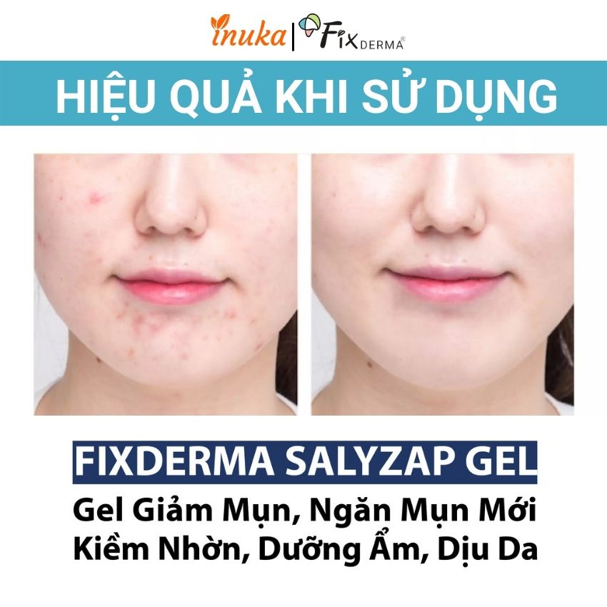 Kem chấm mụn Fixderma giảm ngừa mụn dưỡng ẩm tái tạo dưỡng trắng phục hồi da mờ thâm (gel chấm mụn 20gr) inuka_store.