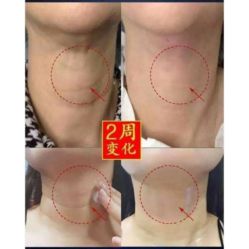 Kem cổ Medipeel chống lão hóa Hàn Quốc