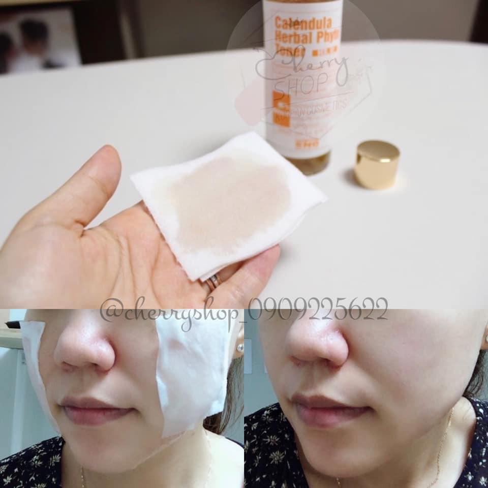 NƯỚC HOA HỒNG HOA CÚC CALENDULA HERBAL PHYTO TONER