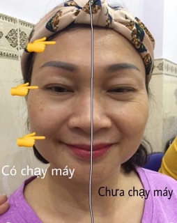 Máy ageloc Gavanic spa