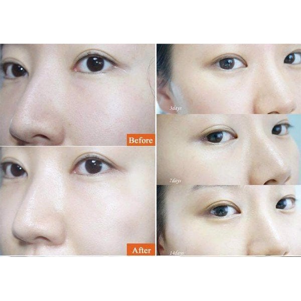 Viên Uống Collagen Cá và Cấp Nước Hyaluronic Acid Innercol Fish | Thế Giới Skin Care