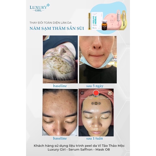 PEEL DA VI TẢO THẢO MỘC LUXURY GIRL