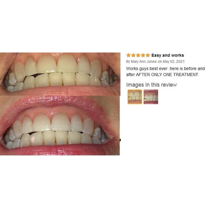 GEL TRẮNG RĂNG CREST KHÔNG Ê BUỐT