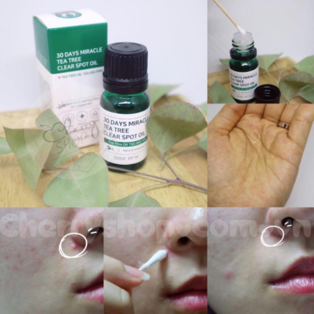 💥🍒Tinh Dầu Tràm Trà "Thần Kỳ" Some By Mi 30 Days Miracle Tea tree Clear spot oil | BigBuy360 - bigbuy360.vn