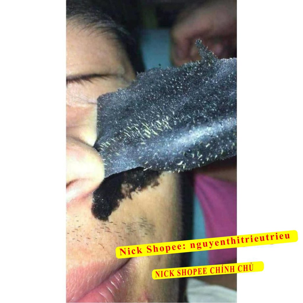 [100% Chính Hãng] Mặt Nạ Gel Hút Mụn Than Tre Hoạt Tính Ngân Bình > Gel lột mụn Than Tre, Lột mụn cám, mụn đầu đen,... | BigBuy360 - bigbuy360.vn