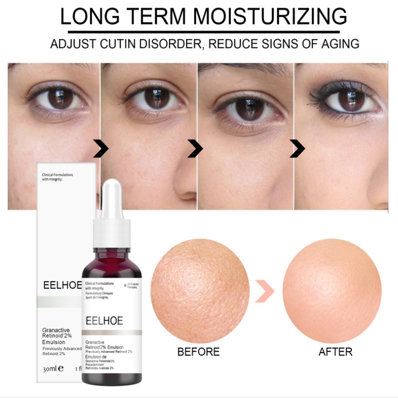 Tinh Chất Axit Salicylic Acid Trái Cây Tẩy Tế Bào Chết Dưỡng Ẩm Nuôi Dưỡng Da