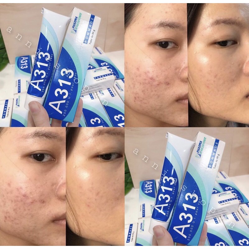 Kem dưỡng Retinol A313 nội địa Pháp