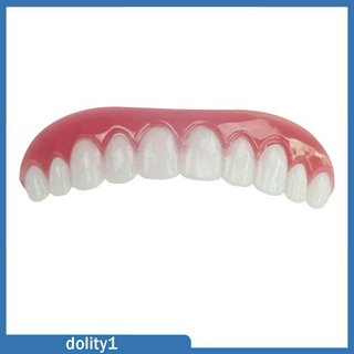[Dolity1] Veneers trên dưới giả sáng