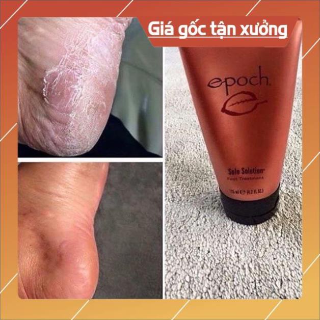 [Chính hãng] CHUYÊN SỈ NUSKIN] KEM TRỊ NỨT GÓT CHÂN - EPOCH SOLE SOLUTION FOOT 125ML | BigBuy360 - bigbuy360.vn