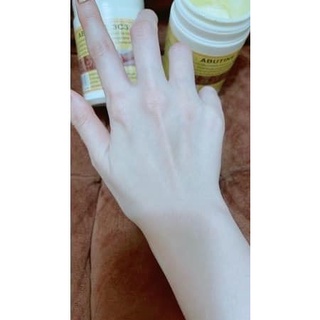 Kích trắng da Abutin 3C3